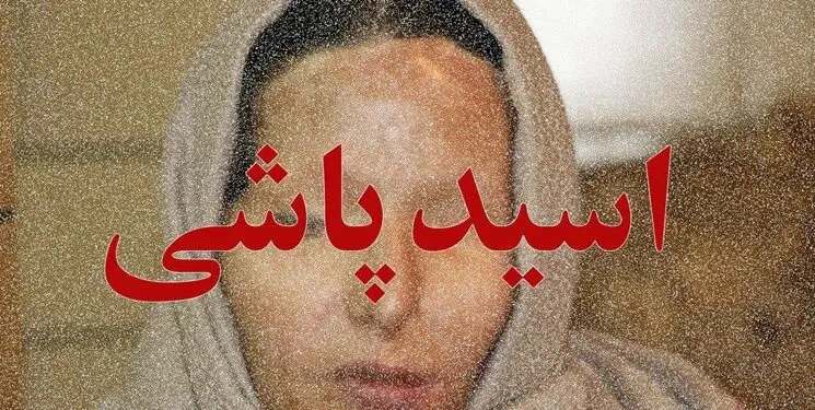 مصوبه مجلس برای اعدام اسیدپاشان