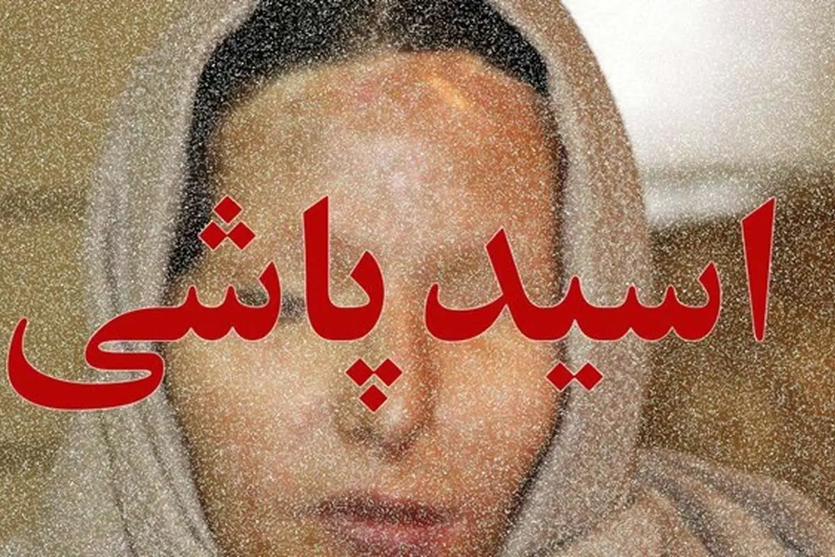 مصوبه مجلس برای اعدام اسیدپاشان