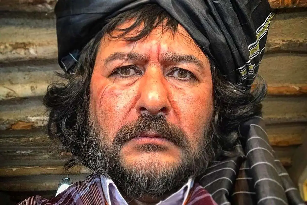 (تصویر) صورت زخمی امیرحسین صدیق در یک فیلم