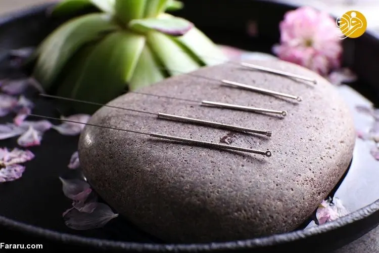 طب سوزنی چیست و فواید و خطرات طب سوزنی کدام اند؟