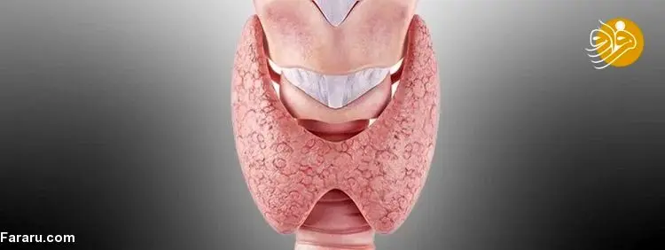 پرکاری تیروئید چه خطراتی دارد و برای درمان آن چه باید کرد؟