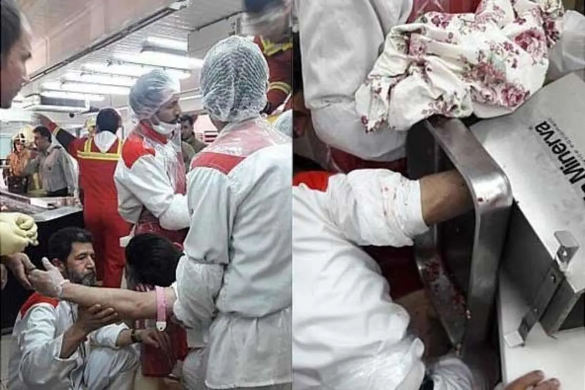 چرخ گوشت صنعتی دست کارگر جوان را بلعید!