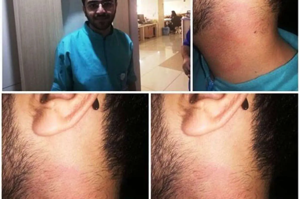 پزشک متخصص اعصاب، پرستار شیرازی را کتک زد!