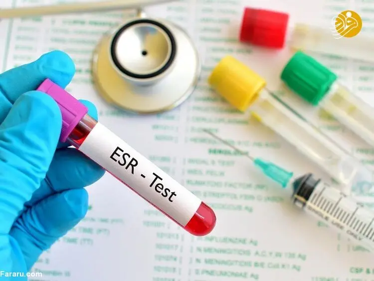 تست ESR خون چیست؟