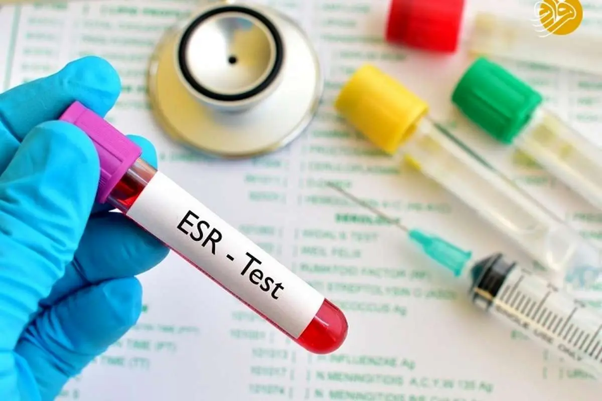 تست ESR خون چیست؟