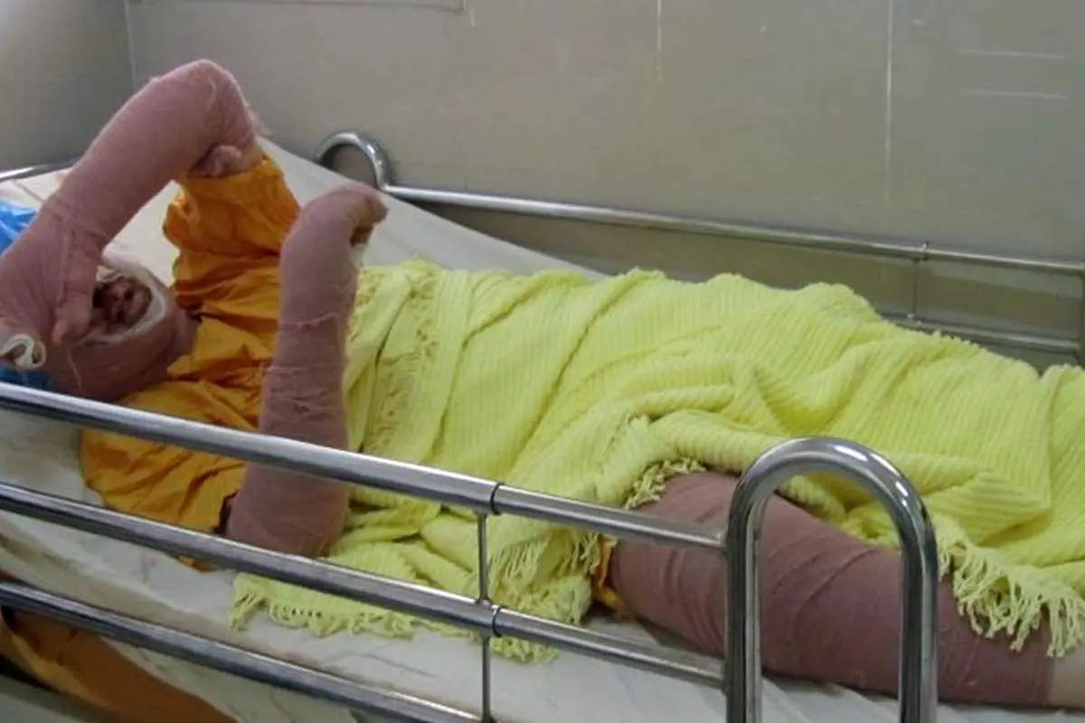 سحر «دختر آبی» درگذشت؛ ماجرای خودسوزی سحر "دختر آبی" چه بود؟
