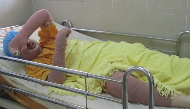 سحر «دختر آبی» درگذشت؛ ماجرای خودسوزی سحر "دختر آبی" چه بود؟