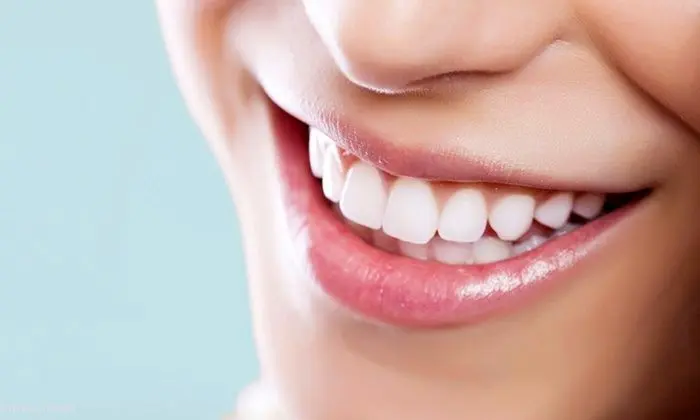 علت زردی دندان چیست و برای سفید کردن دندان ها چه کنیم؟