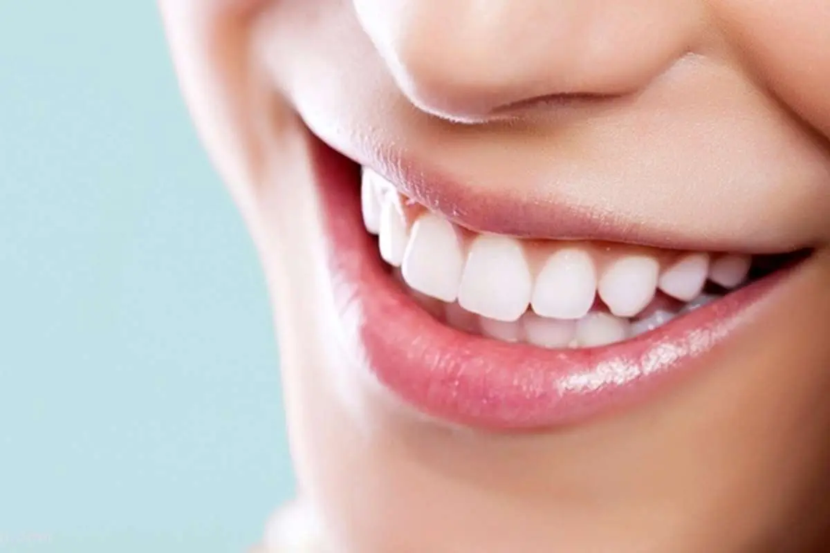 علت زردی دندان چیست و برای سفید کردن دندان ها چه کنیم؟