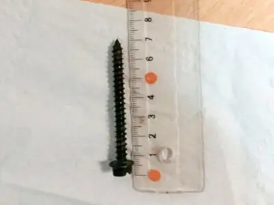 (عکس) خارج کردن پیچ ۷ سانتی از معده کودک بوشهری