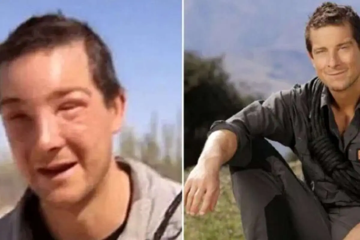 (عکس) بلایی که زنبورها بر سر مجری تلویزیون آوردند!