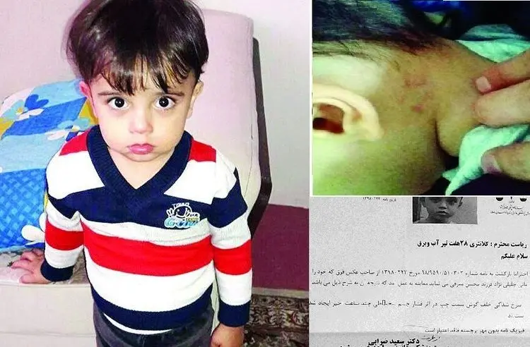 لحظات دردناک یک کودک دیگر زیر دست دندانپزشک