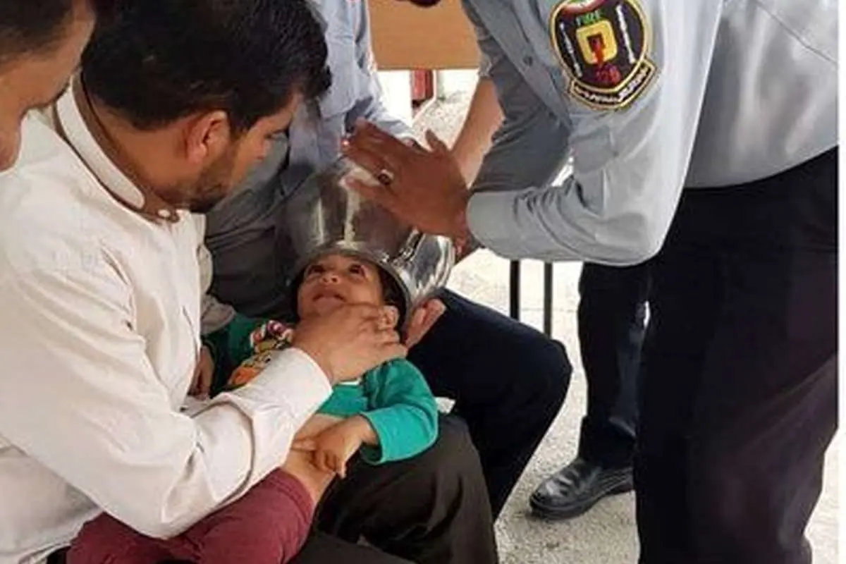 (عکس) گیر کردن سر کودک یکساله در دیگ زودپز!