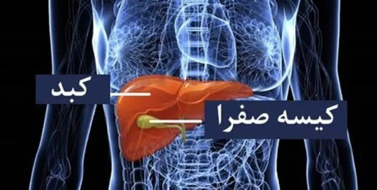سنگ کیسه صفرا چگونه به وجود می‌آید؟