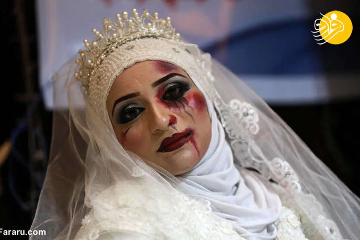 (تصاویر) عروسهای فلسطینی با سر و صورت کبود
