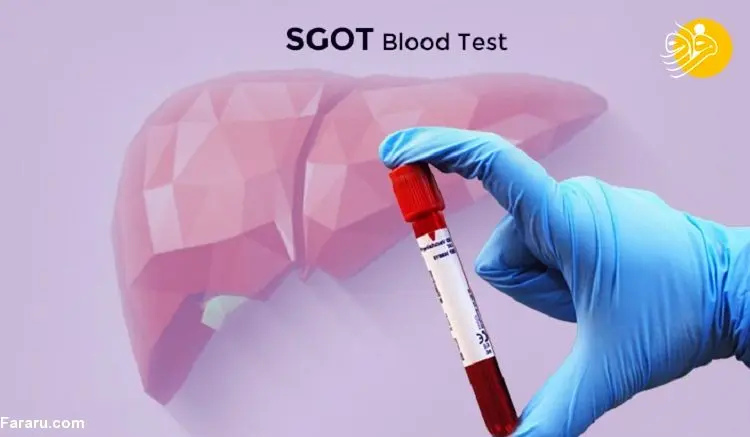 آزمایش SGOT یا AST چیست و این آزمایش چرا باید انجام شود؟