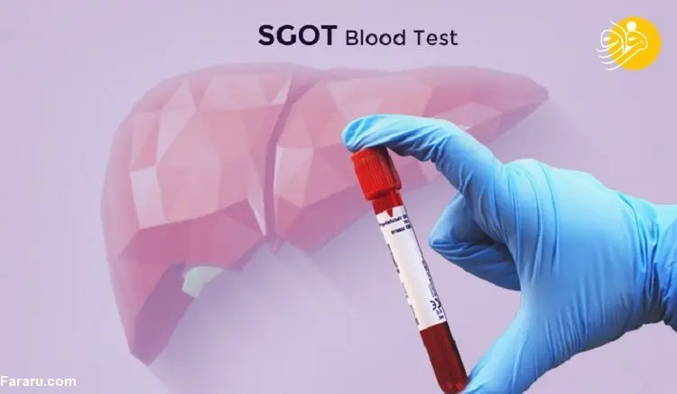 آزمایش SGOT یا AST چیست و این آزمایش چرا باید انجام شود؟