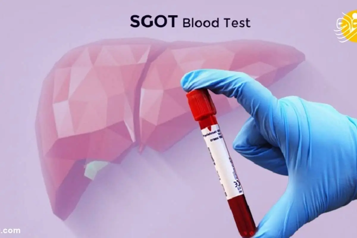 آزمایش SGOT یا AST چیست و این آزمایش چرا باید انجام شود؟