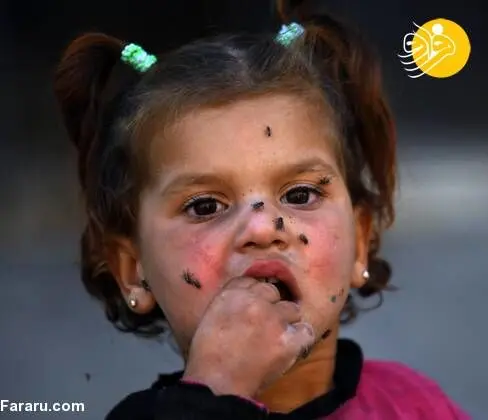 (تصاویر) جولان مگس‌ها روی صورت دختربچه سوری