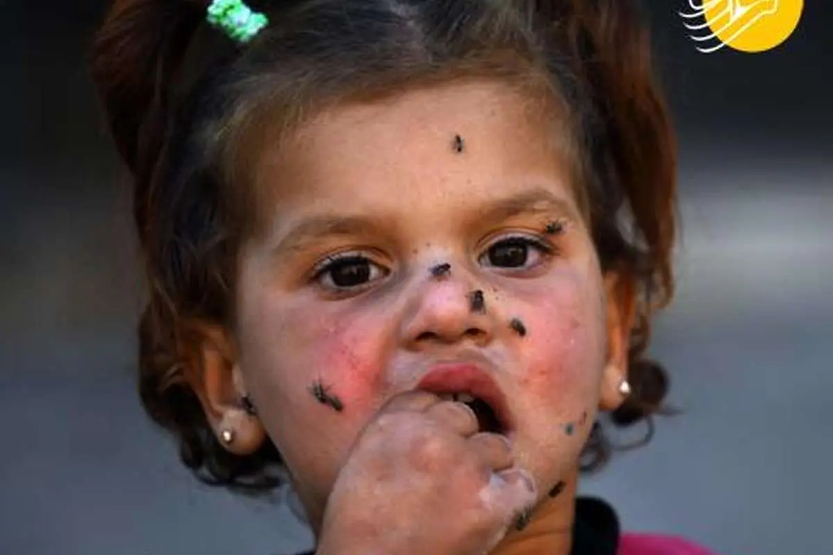 (تصاویر) جولان مگسها روی صورت دختربچه سوری