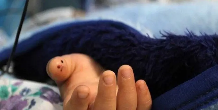 مرگ دلخراش کودک ۶ ساله زیر چرخ‌های کامیون حمل زباله در قم