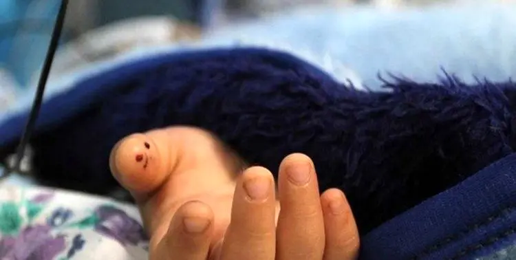 مرگ دلخراش کودک ۶ ساله زیر چرخ‌های کامیون حمل زباله در قم