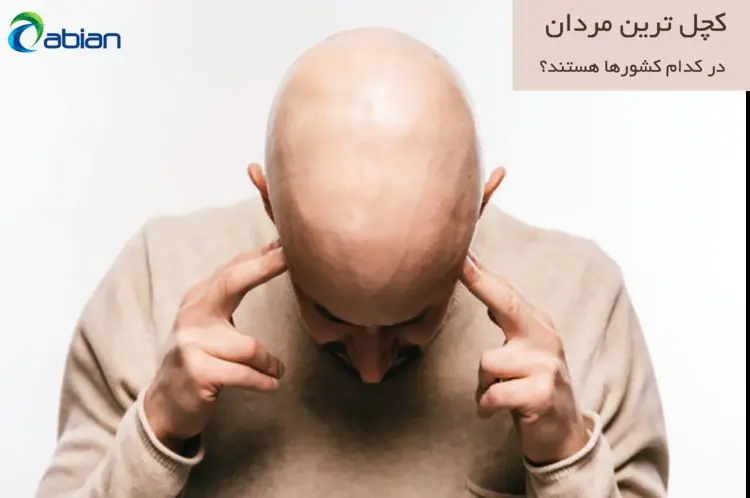 معجزه مولتی ویتامین در کمک به جلوگیری از ریزش مو