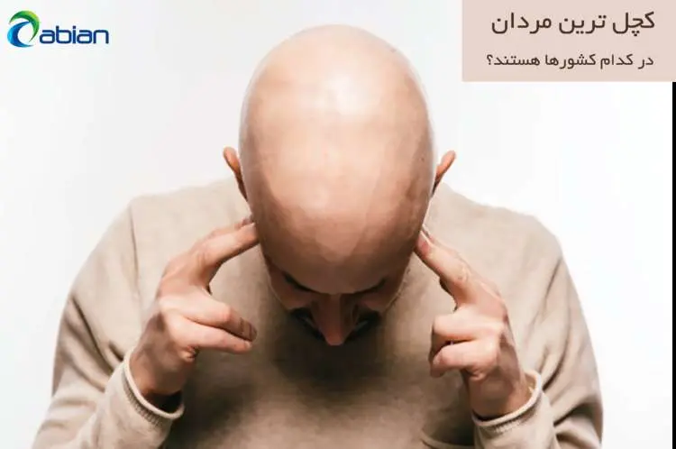 معجزه مولتی ویتامین در کمک به جلوگیری از ریزش مو