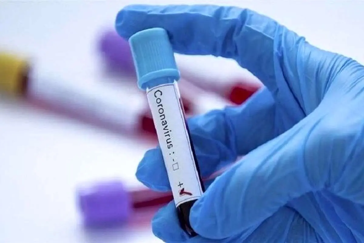 احتمال ابتلای اطرافیان ۲ بیمار فوتشده به کرونا زیاد است