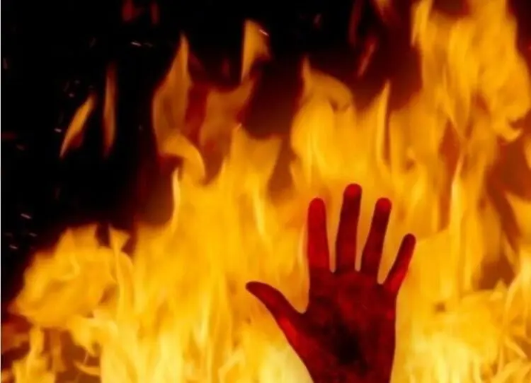 عروس ۱۷ ساله بعد از ازدواج اجباری خودش را به آتش کشید!