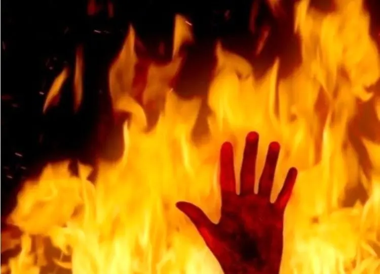 عروس ۱۷ ساله بعد از ازدواج اجباری خودش را به آتش کشید!