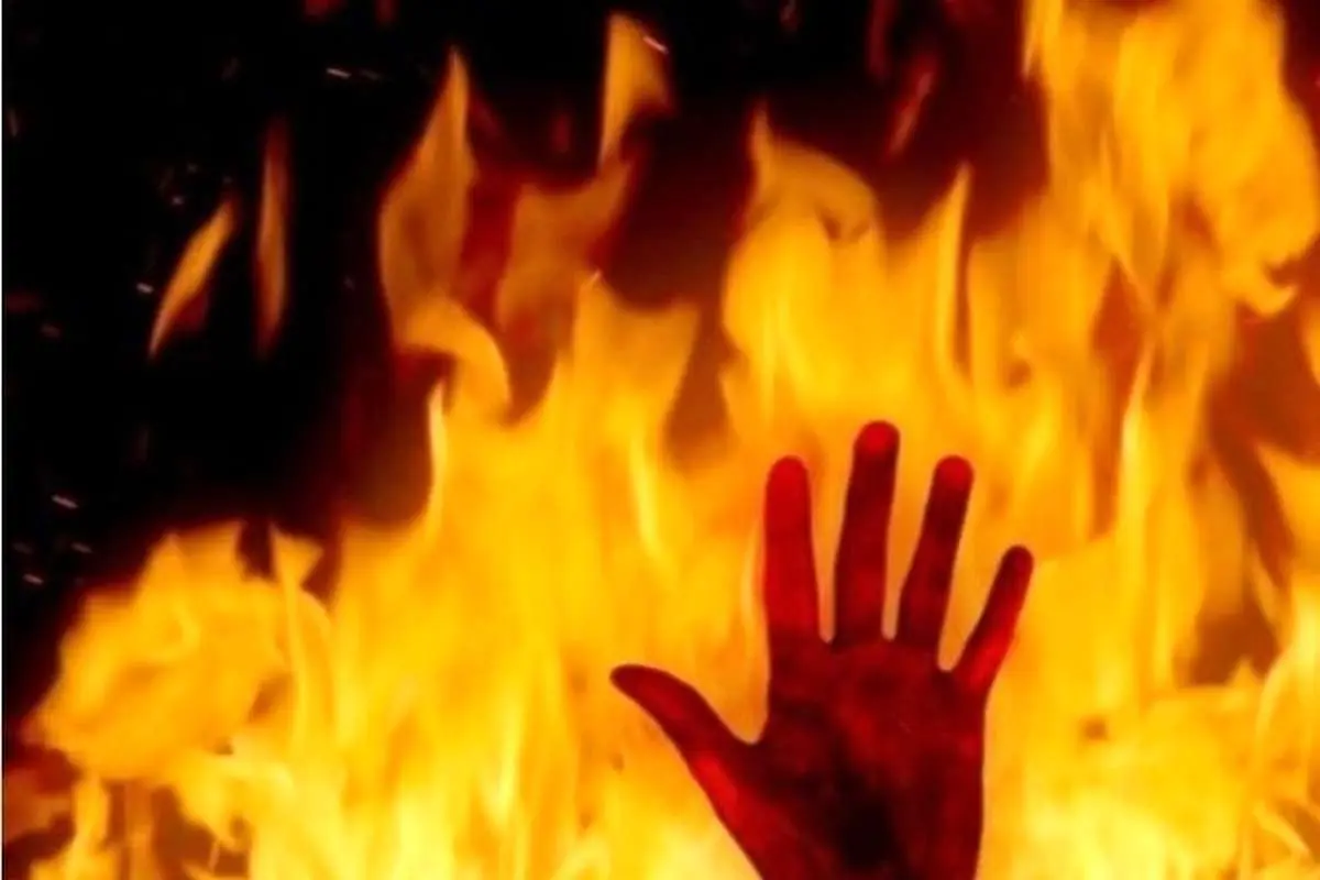 عروس ۱۷ ساله بعد از ازدواج اجباری خودش را به آتش کشید!
