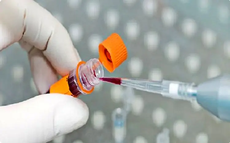 موفقیت محققان کشور در تولید کیت تشخیص کرونا