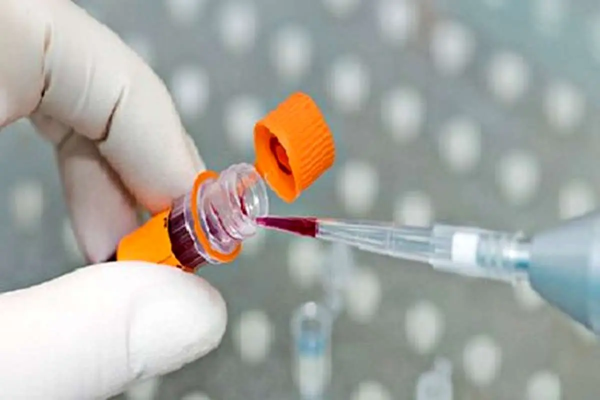 موفقیت محققان کشور در تولید کیت تشخیص کرونا