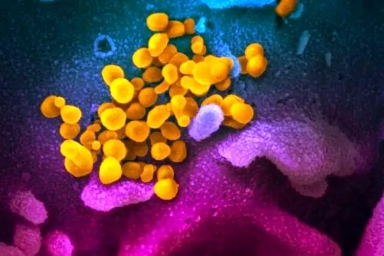 بیش از ۳۰ درصد بیماران کرونا علائم عصبی دارند