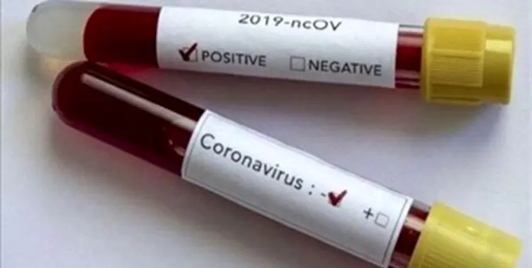 کیت‌ ایرانی تشخیص کرونا ⁩به ترکیه و آلمان صادر شد