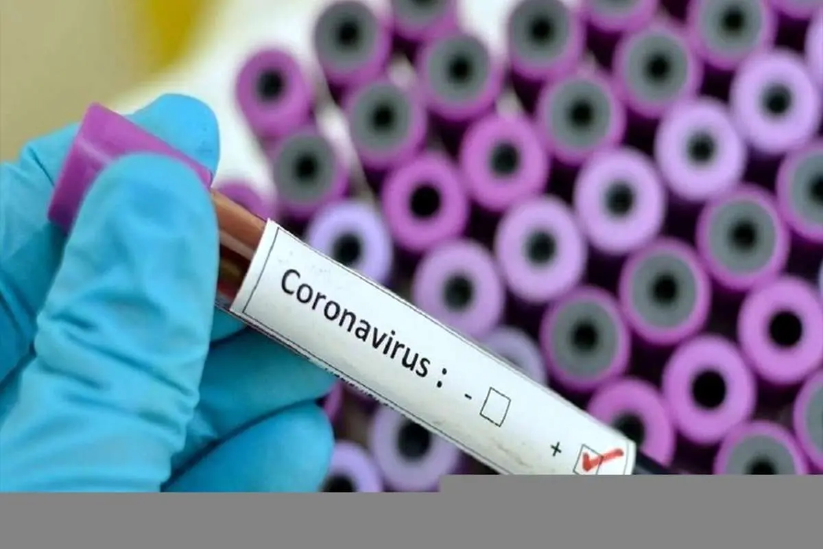 رونمایی از سامانهای برای تشخیص کرونا در ۵ ثانیه