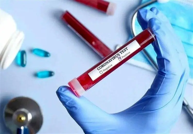 تایید داروی ایرانی ضدالتهاب ریه در درمان مبتلایان کرونا