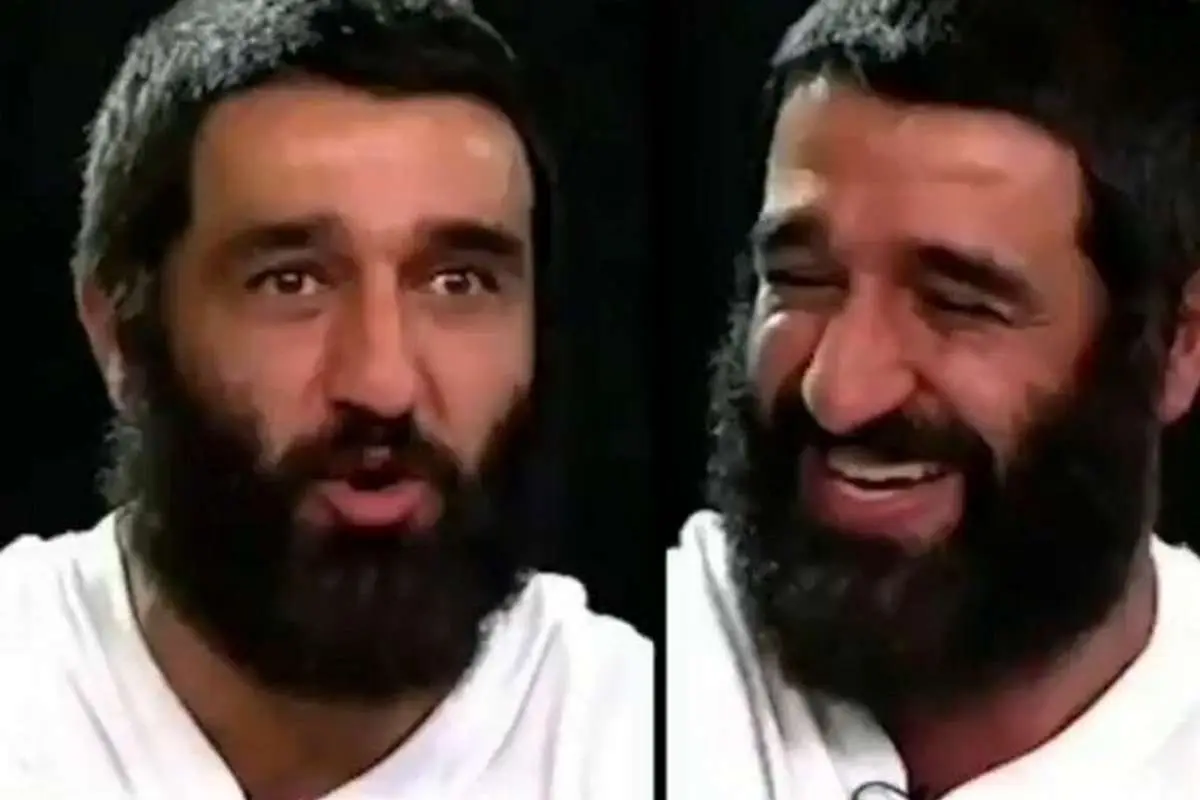 راز تغییر چهره پژمان جمشیدی از زبان خودش