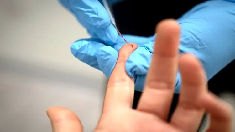 رئیس بیمارستان بقیه‌الله: فرد دارای آنتی بادی تا ۶ ماه کرونا نمی‌گیرد