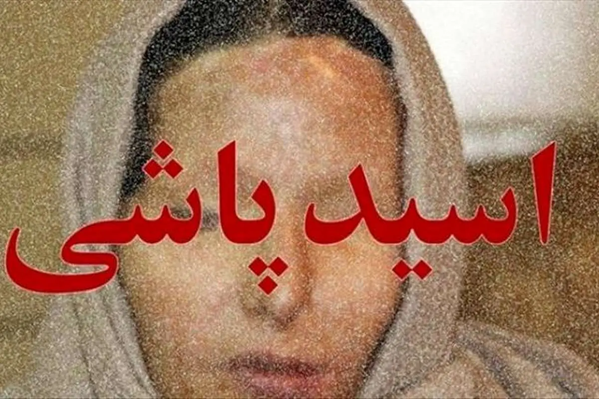 مرد سنگدل کرجی همسر و دختر خود را با اسید سوزاند+جزییات