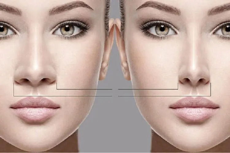 جراحی زیبایی بینی و هرآنچه باید درباره آن بدانید