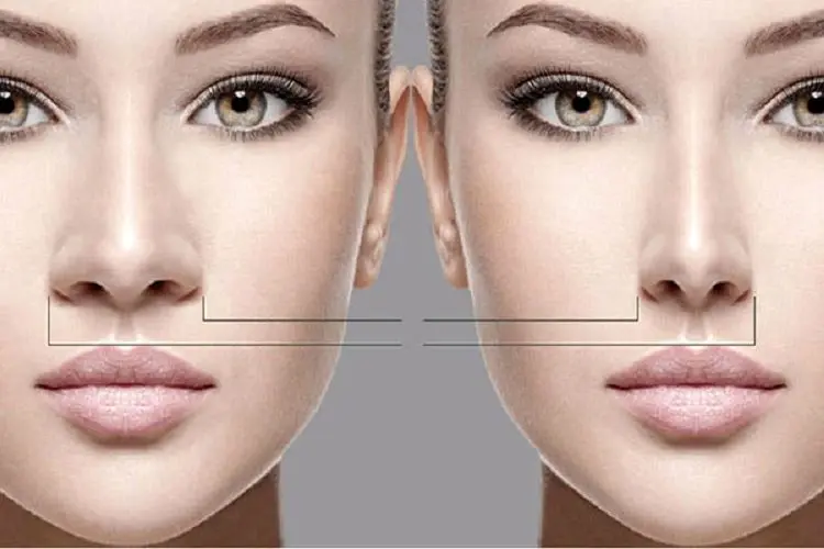 جراحی زیبایی بینی و هرآنچه باید درباره آن بدانید