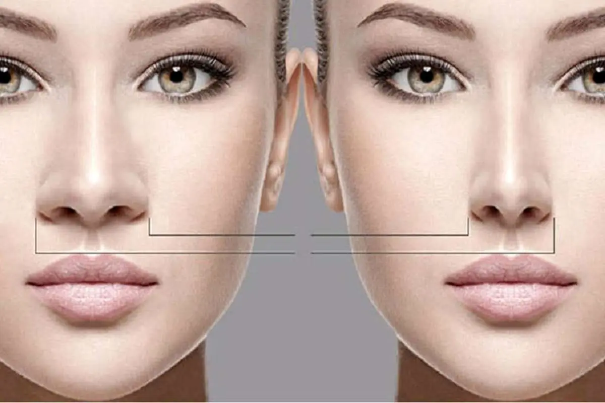 جراحی زیبایی بینی و هرآنچه باید درباره آن بدانید