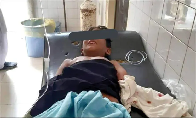 «گاندو»‌ دست‌ پسر‌بچه ‌چابهاری ‌را‌ خورد