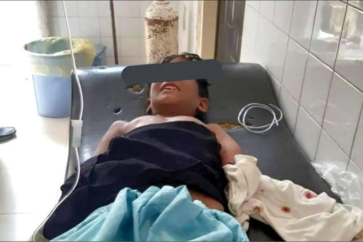 «گاندو» دست پسربچه چابهاری را خورد