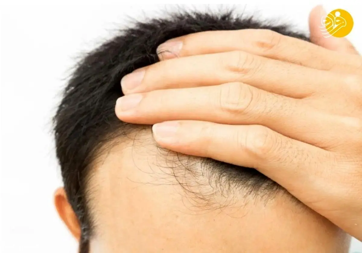 آیا بیوتین برای تقویت رشد مو مفید است؟