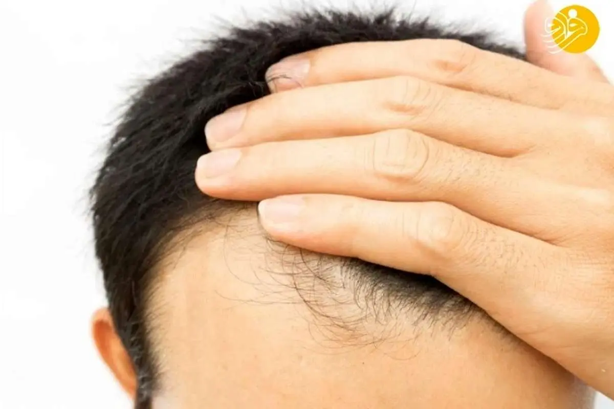 آیا بیوتین برای تقویت رشد مو مفید است؟