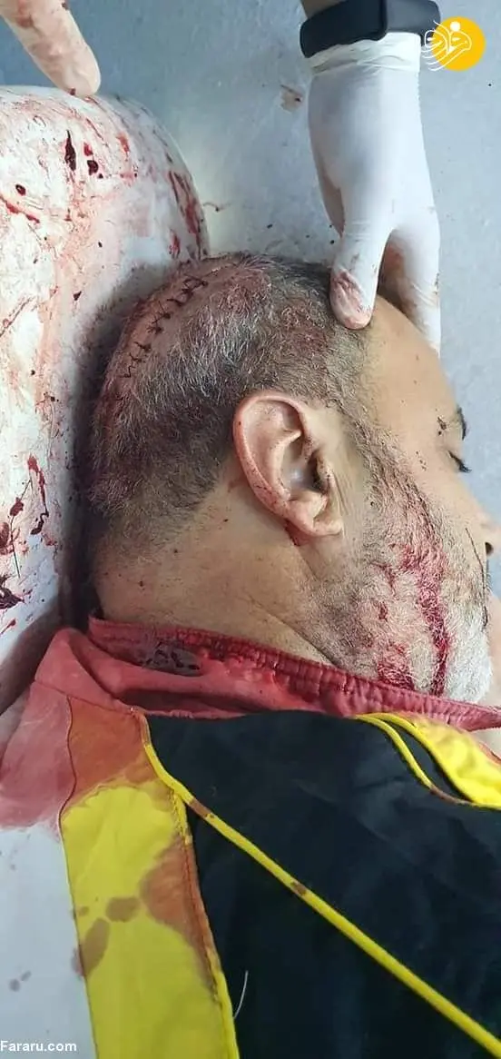 (تصاویر +16) حمله با شمشیر به نماینده پارلمان تونس