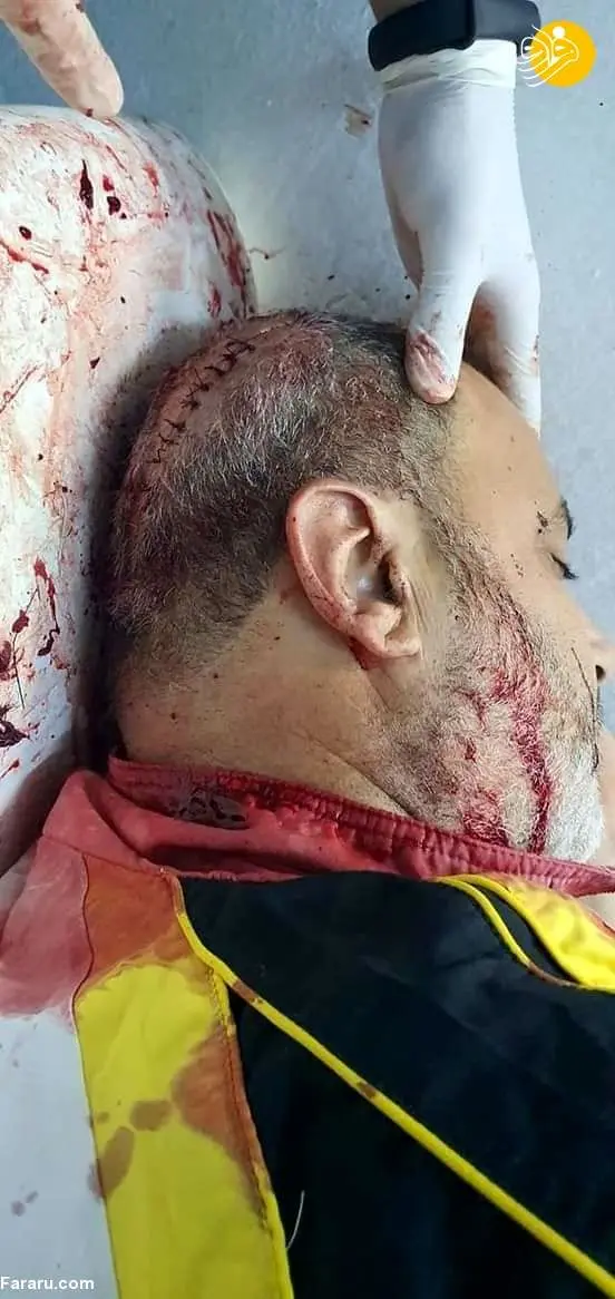 (تصاویر +16) حمله با شمشیر به نماینده پارلمان تونس
